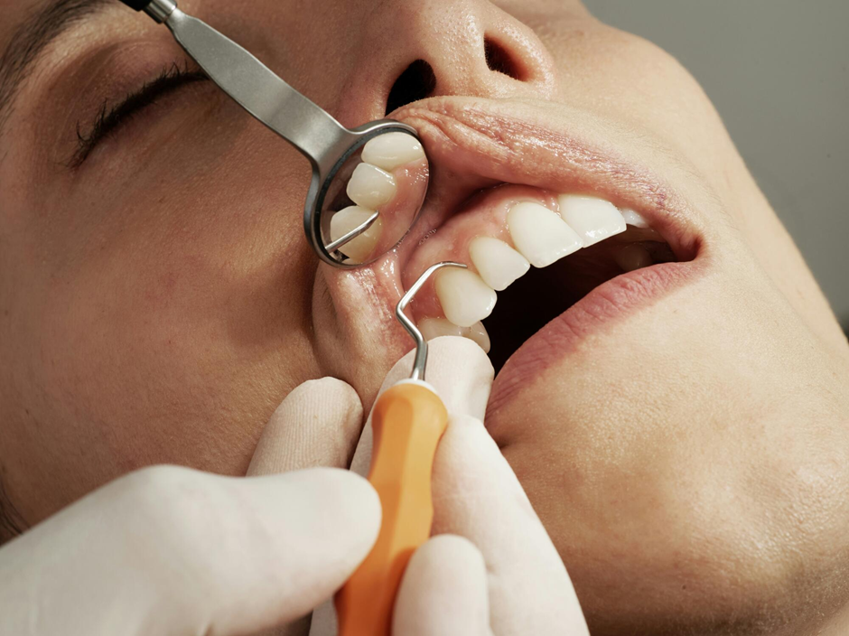 How Pediatric Dental Care Protects Growing Smiles Early